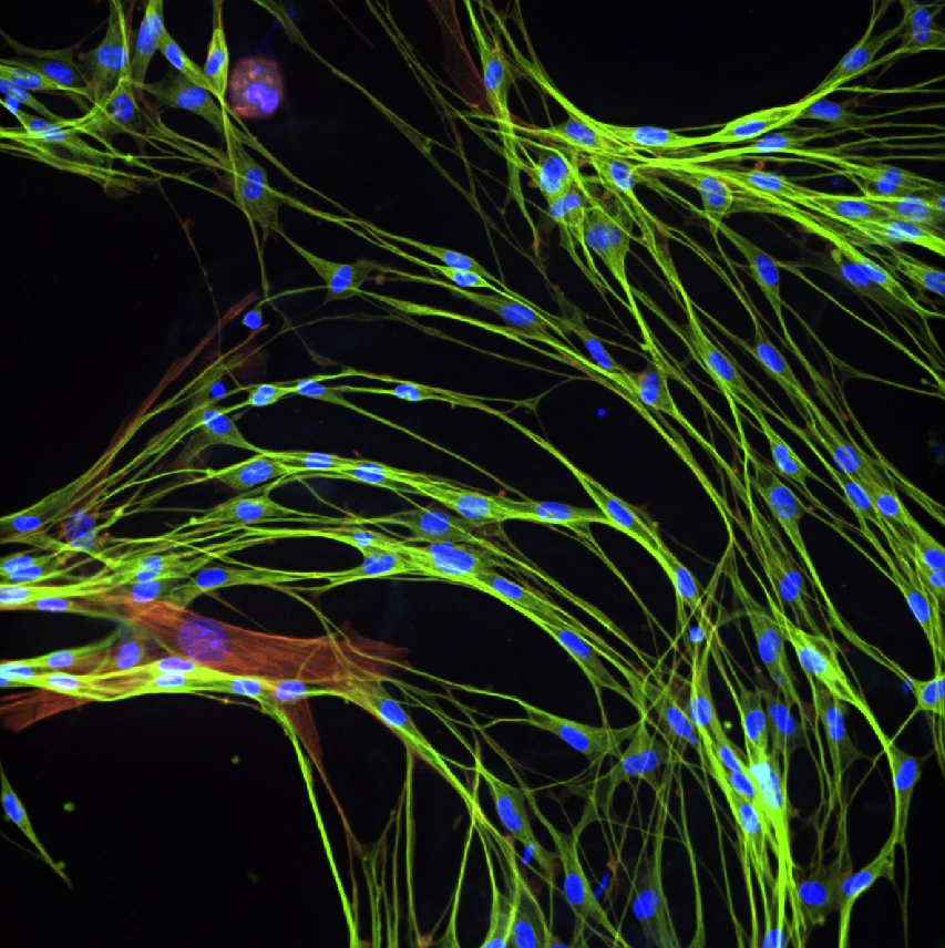 Fluorescence microscopy of enteric neurons.