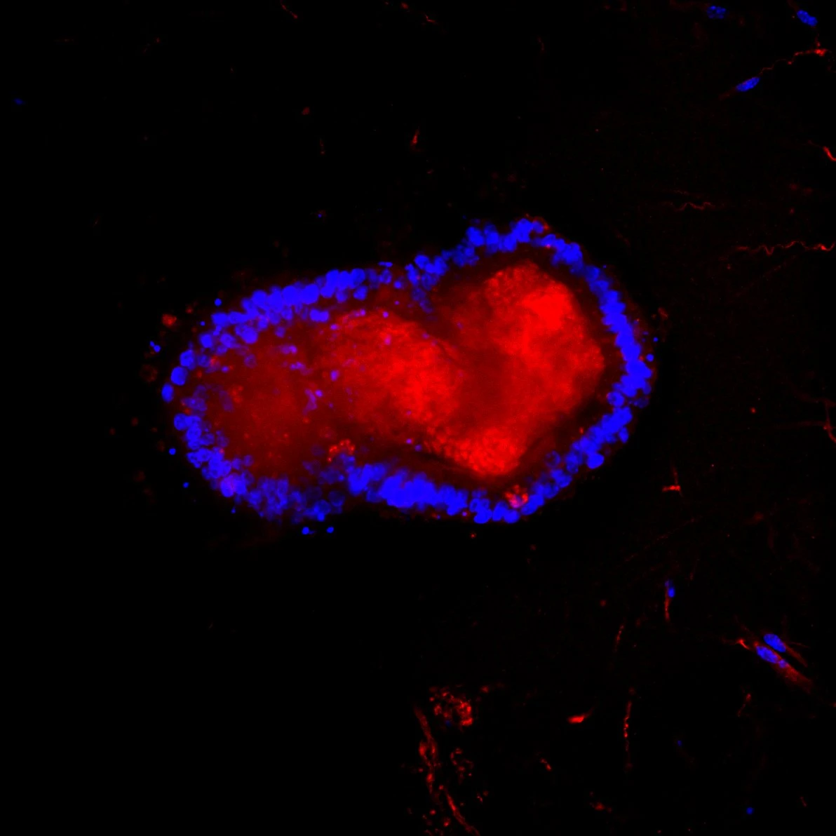 Fluorescence microscopy of an intestinal organoid.